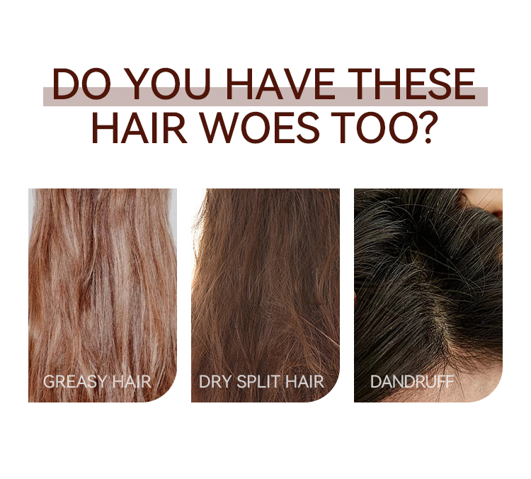 Controle de &oacute;leo